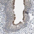 Anti-RIPK2 Antibody