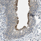 Anti-RIPK2 Antibody