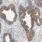 Anti-RIPK2 Antibody