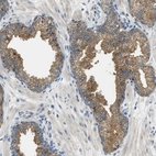 Immunohistochemical staining of human prostate shows moderate cytoplasmic positivity in glandular cells.