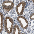 Anti-RIPK2 Antibody