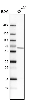 Western blot analysis in human cell line EFO-21.