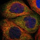 Immunofluorescent staining of human cell line A-431 shows localization to cytosol.