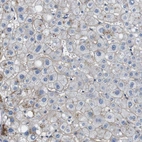 Anti-SLC30A1 Antibody