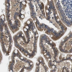 Immunohistochemical staining of human duodenum shows strong membranous positivity in glandular cells.