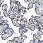 Immunohistochemical staining of human placenta shows moderate membranous positivity in trophoblastic cells.