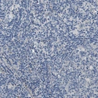 Immunohistochemical staining of human lymph node shows no positivity in non-germinal center cells as expected.