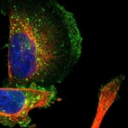 Immunofluorescent staining of human cell line U-251 MG shows localization to plasma membrane & vesicles.
