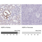 Anti-AQP6 Antibody