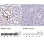 Anti-AQP6 Antibody