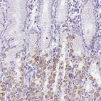Immunohistochemical staining of human stomach shows moderate to strong cytoplasmic positivity in a subset of glandular cells.
