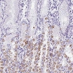 Immunohistochemical staining of human stomach shows moderate to strong cytoplasmic positivity in a subset of glandular cells.