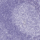 Immunohistochemical staining of human tonsil shows no positivity in germinal center cells as expected.