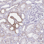 Immunohistochemical staining of human kidney shows moderate to strong cytoplasmic positivity in cells in tubules.