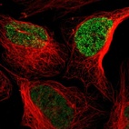 Immunofluorescent staining of human cell line U-2 OS shows localization to nucleoplasm.