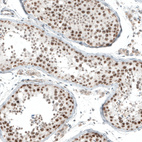 Anti-HLTF Antibody