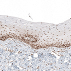Immunohistochemical staining of human cervix, uterine shows moderate to strong nuclear positivity in squamous epithelial cells.