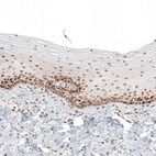 Anti-HLTF Antibody