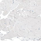 Immunohistochemical staining of human skeletal muscle shows no positivity in myocytes as expected.