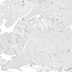 Immunohistochemical staining of human skeletal muscle shows no positivity in myocytes as expected.