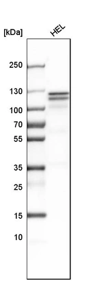 Western blot analysis in human cell line HEL.