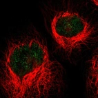 Immunofluorescent staining of human cell line A-431 shows localization to nucleoplasm.