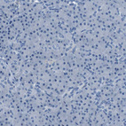 Immunohistochemical staining of human pancreas shows no cytoplasmic positivity in exocrine glandular cells as expected.