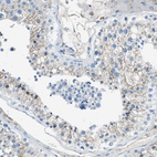 Immunohistochemical staining of human testis shows moderate membranous positivity in cells in seminiferous ducts.