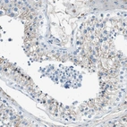 Immunohistochemical staining of human testis shows moderate membranous positivity in cells in seminiferous ducts.