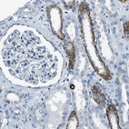 Immunohistochemical staining of human kidney shows moderate cytoplasmic positivity in cells in distal tubules.
