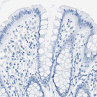 Immunohistochemical staining of human colon shows no positivity in glandular cells.