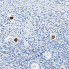 Anti-SALL4 Antibody