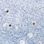 Immunohistochemical staining of human ovary shows moderate nuclear positivity in follicle cells.