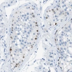 Immunohistochemical staining of human testis shows weak nuclear positivity in cells in seminiferous ducts.