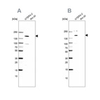 Western blot analysis using Anti-SALL4 antibody HPA015291 (A) shows similar pattern to independent antibody HPA015791 (B).
