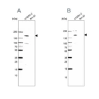 Western blot analysis using Anti-SALL4 antibody HPA015291 (A) shows similar pattern to independent antibody HPA015791 (B).