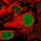 Immunofluorescent staining of human cell line CACO-2 shows localization to nucleoplasm.