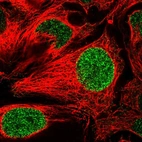 Immunofluorescent staining of human cell line CACO-2 shows localization to nucleoplasm.