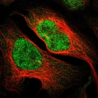 Immunofluorescent staining of human cell line U-2 OS shows localization to nucleoplasm.