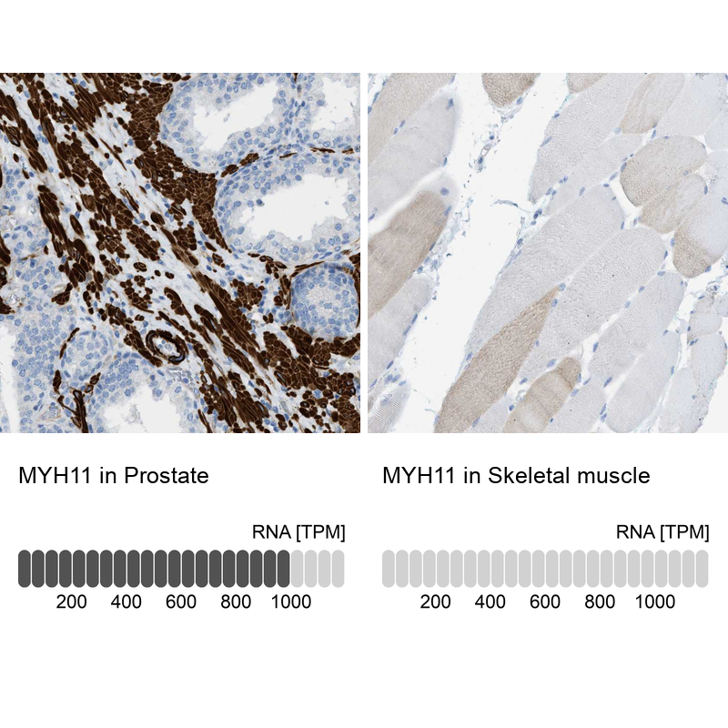 Anti-MYH11 Antibody