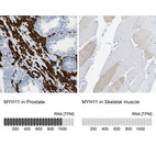 Anti-MYH11 Antibody