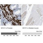 Anti-MYH11 Antibody