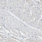 Immunohistochemical staining of human heart muscle shows no positivity in cardiomyocytes as expected.