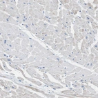 Immunohistochemical staining of human heart muscle shows no positivity in cardiomyocytes as expected.