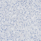 Immunohistochemical staining of human liver shows no positivity in hepatocytes as expected.