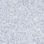 Immunohistochemical staining of human liver shows no positivity in hepatocytes as expected.