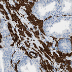 Immunohistochemical staining of human prostate shows very strong cytoplasmic positivity in smooth muscle cells.