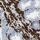 Immunohistochemical staining of human prostate shows very strong cytoplasmic positivity in smooth muscle cells.