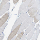 Immunohistochemical staining of human skeletal muscle shows no positivity in myocytes as expected.