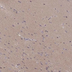 Immunohistochemical staining of human cerebral cortex shows high expression.